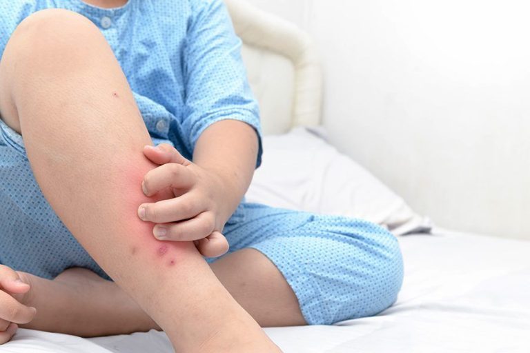 پشه‌ در کمین چه افرادی است؟