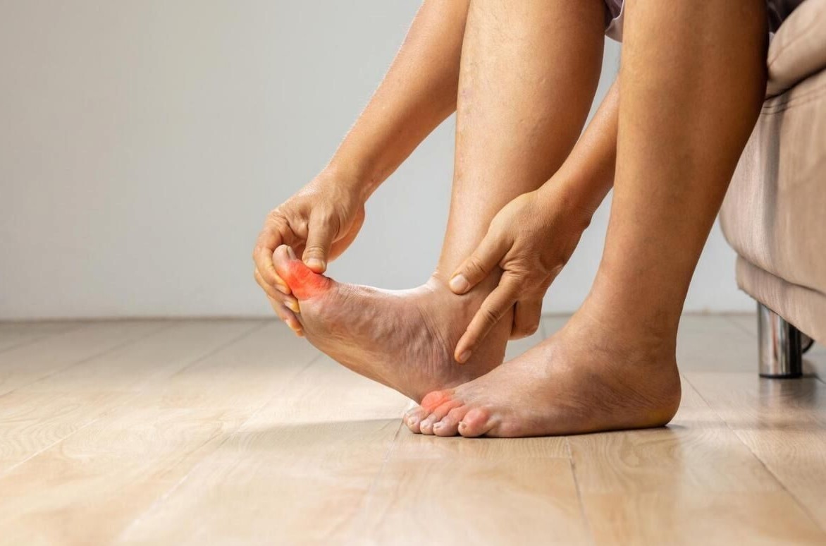 درمان ورم پا با پیاز - درمان خانگی ورم پا