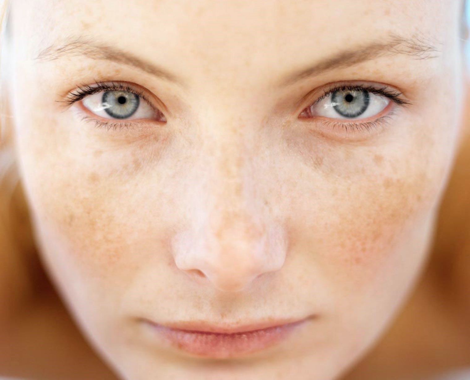 علت لکه های قهوه ای صورت - لک صورت