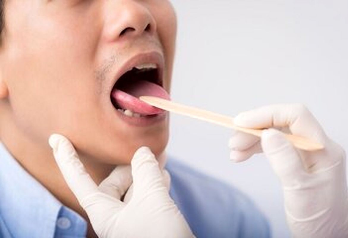 علت سبز شدن زبان - تشخیص بیماری از رنگ زبان