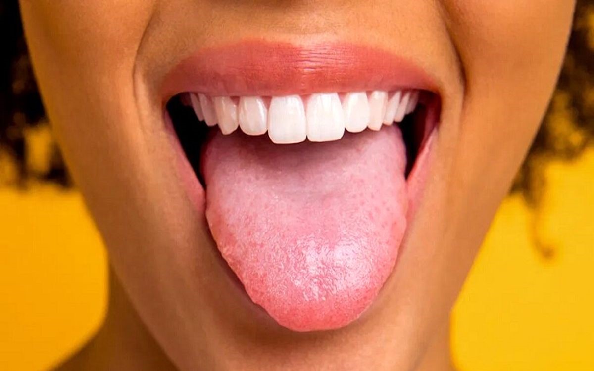 زبان قرمز - تشخیص بیماری از رنگ زبان