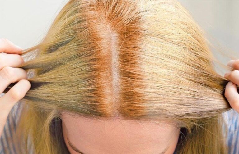 از بین بردن زردی مو با رنگ دودی