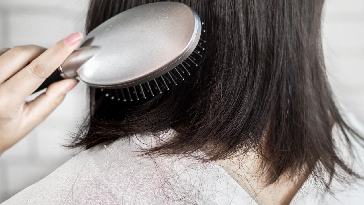 ریزش موی ناشی از تنبلی تخمدان - ریزش مو ناشی از سندرم تخمدان