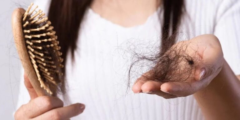 pcos-cause-hair-loss-1669709340299