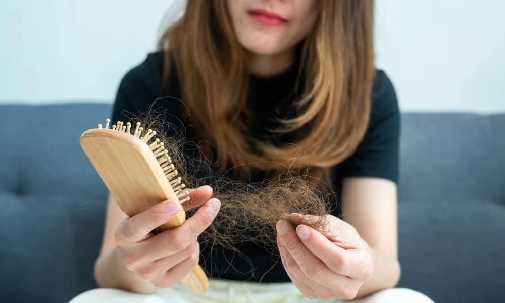 خانمی کلافه از ریزش موی خود | جلوگیری از ریزش مو