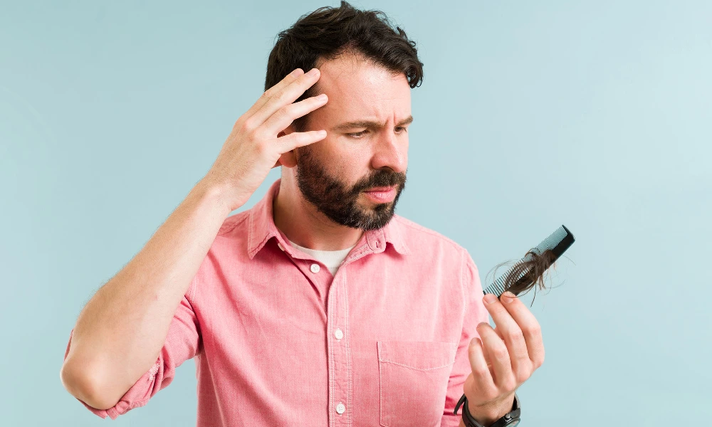 مردی به شانه سر خود نگاه میکند | جلوگیری از ریزش مو