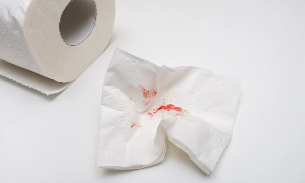 یک تکه دستمال کاغذی خونی | علت تیرگی مدفوع