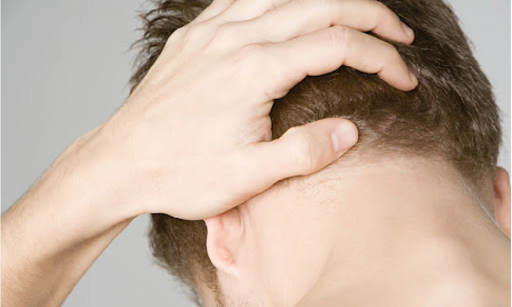 علت درد پشت سر | فردی که پشت سرش را میفشارد